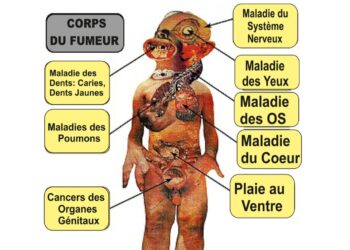 Lutte contre le tabagisme : la détermination sans faille de ‘’Génération Sans Tabac’’ en Guinée