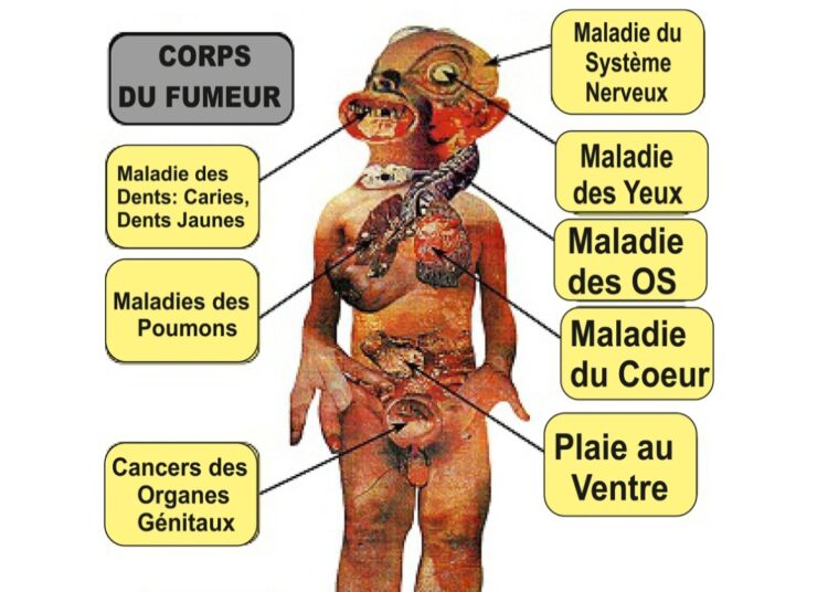 Lutte contre le tabagisme : la détermination sans faille de ‘’Génération Sans Tabac’’ en Guinée